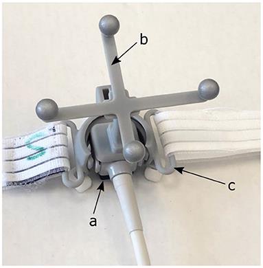 Case Report: Treatment Planning Study to Demonstrate Feasibility of Transthoracic Ultrasound Guidance to Facilitate Ventricular Tachycardia Ablation With Protons